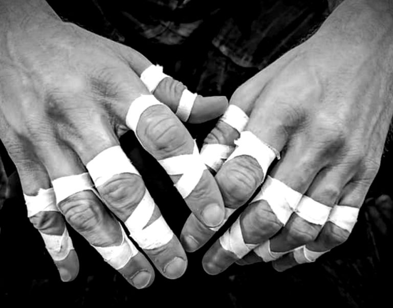 How to Deal with Finger Pain in BJJ: A Complete Guide